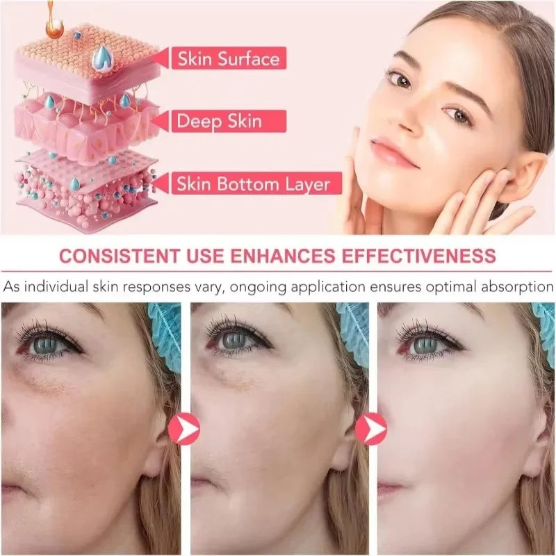 Collagen Jelly Essence Cream 100g – Soft Spa Facial Moisturizer for Pores & Comedone Removal