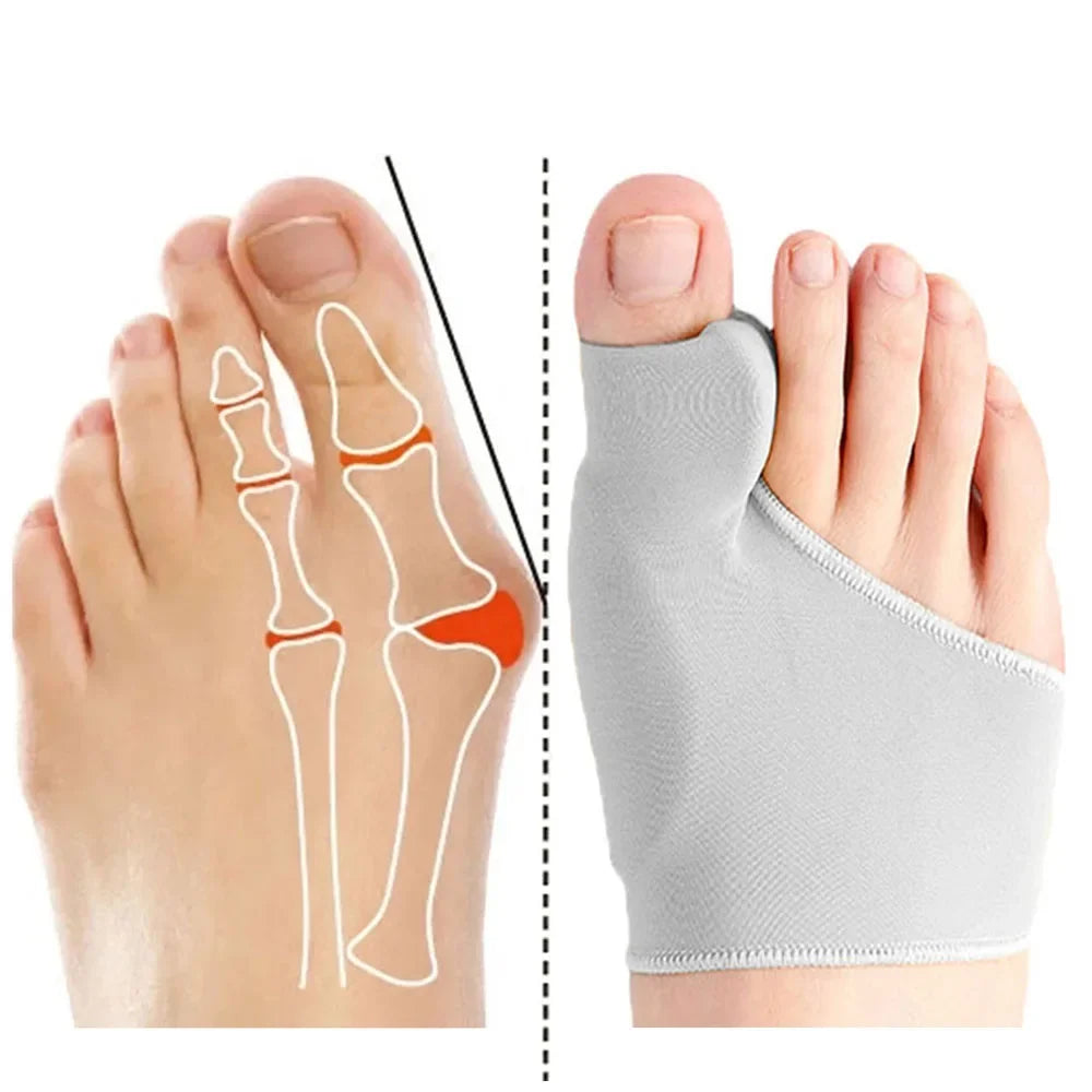 Bunion Corrector Toe Separator - Foot Pain Relief and Alignment Tool