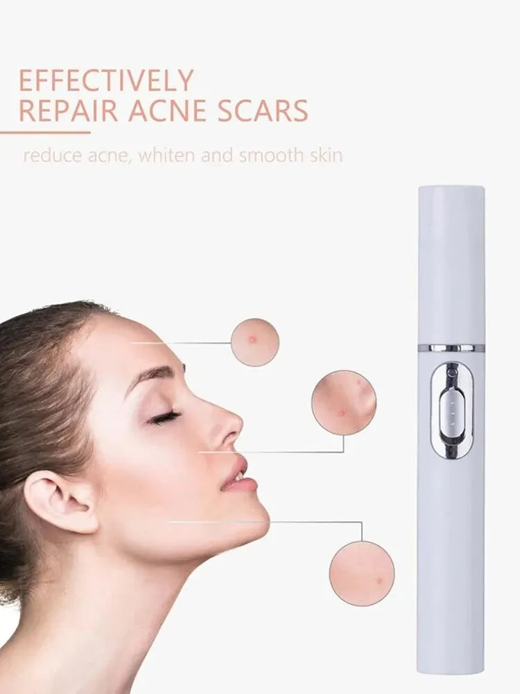 BrightEyes Blue Light Massager – Smooth Fine Lines & Refresh Under-Eyes