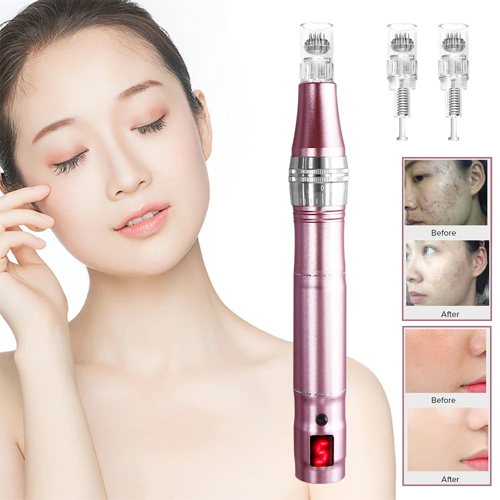 Professional High Frequency Skin Tightening Tool – Wireless, Rechargeable & Multifunctional for Home Use